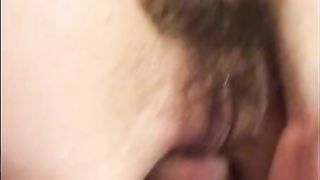 Anal prolapse pumping